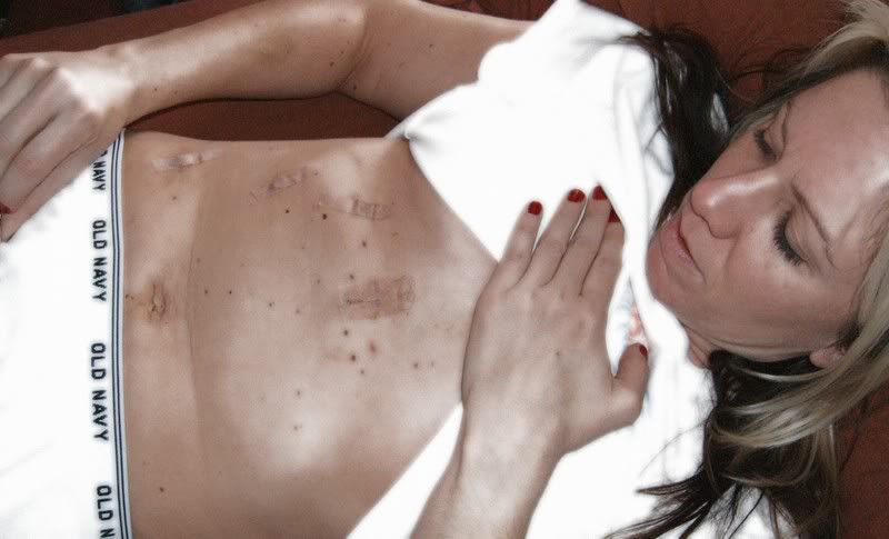 If moles and stretch-marks gross you out, look away now: