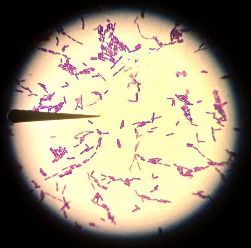 BacteriaB-GramPositiveRod.jpg