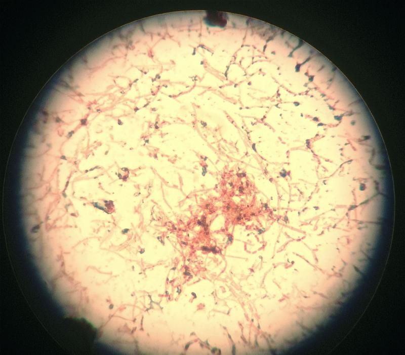 BacteriaB-SporeStain.jpg