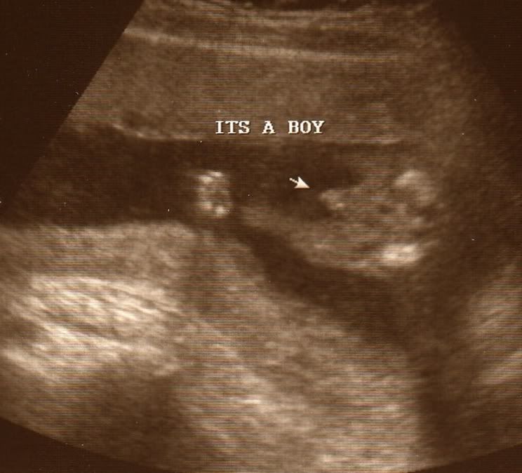 It's a Boy!