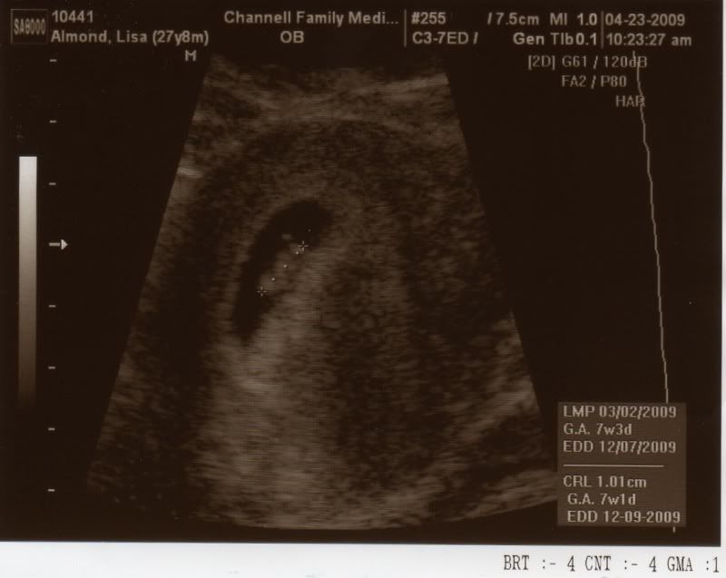 Baby Almond's first pic