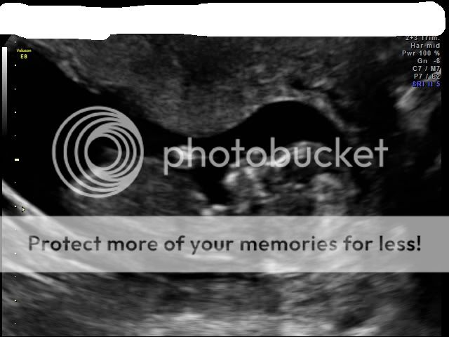 SHULTZ_ALLISON_4.jpg picture by amcken